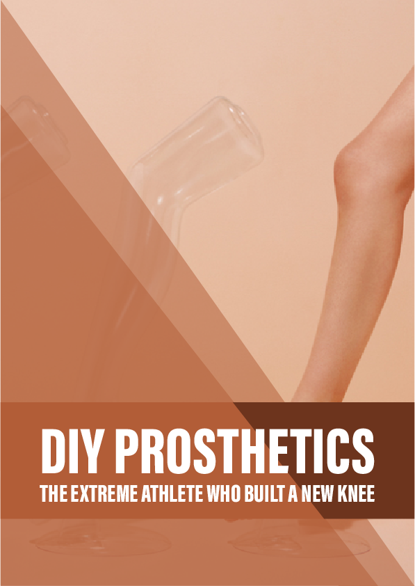 DIY prosthetics: the extreme athlete who built a new knee